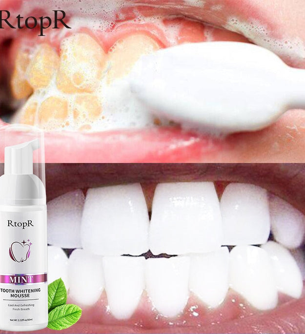 Tooth Whitening Mousse